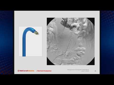 Management of Acute Aortic Endograft Complications