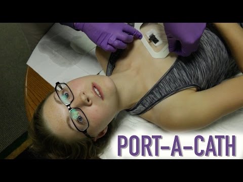 HOW TO ACCESS A PORT-A-CATH (IMPLANTED PORT) Video