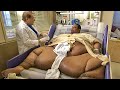 Can You Guess His Weight Most Overweight People In The World