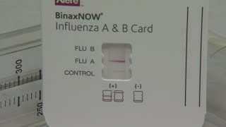 Flu cases are on the rise. Here are the symptoms to look out for