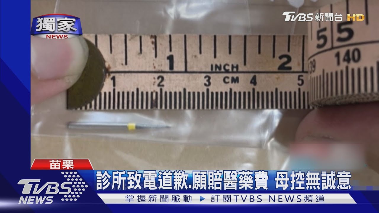 「針」恐怖！母控牙醫　換磨牙針掉入3歲兒嘴