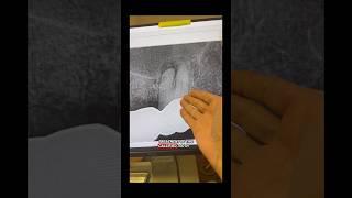 No cbct. #dentists #dentalcare #rootcanaltherapy @FlexivoDental