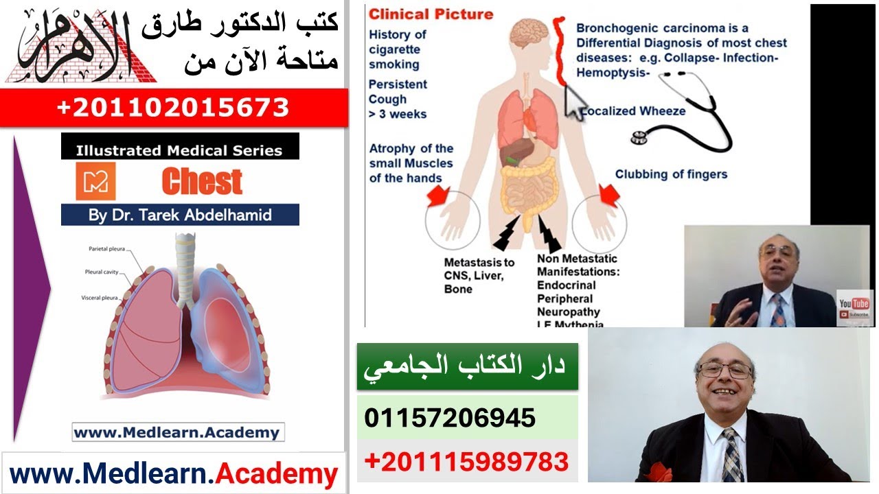 Bronchogenic Carcinoma   #cme #internal_medicine #medical #usmle #محاضرات_باطنة
