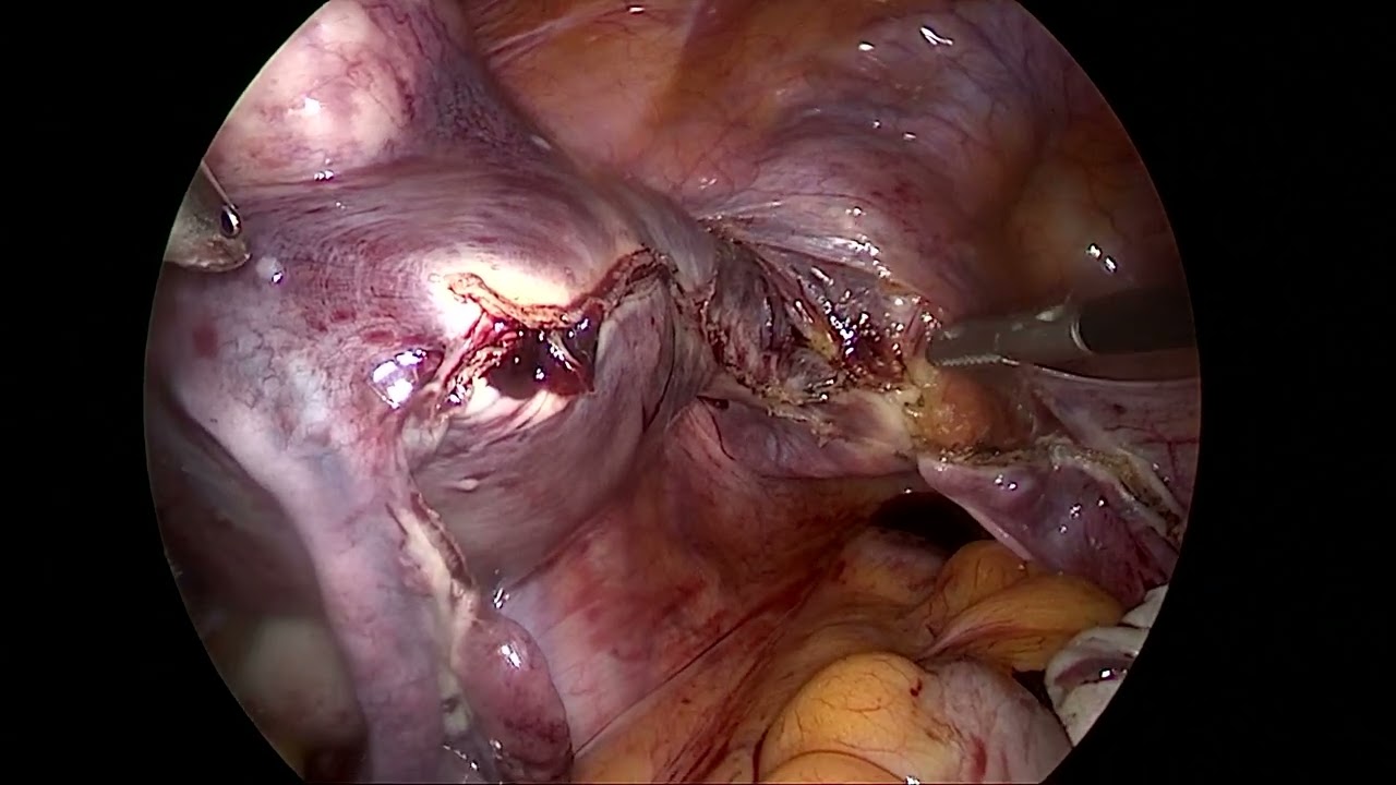 Jose Cantillo Pabon-4