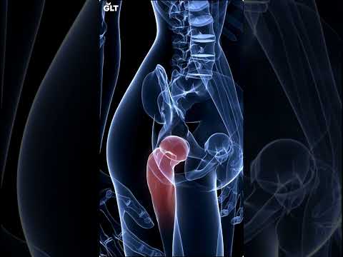 6 Benefits of Collagen Supplement #collagen