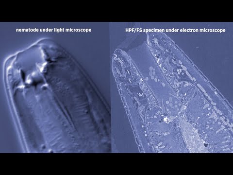 Using high pressure freezing to image microscopic worms
