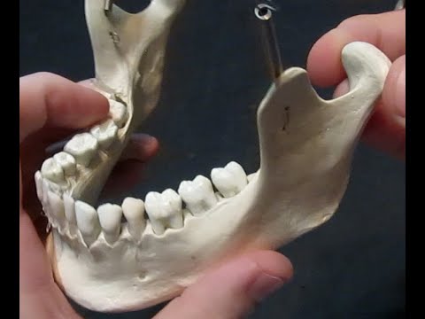 Identification of Bony Landmarks - Mandible (Skull)