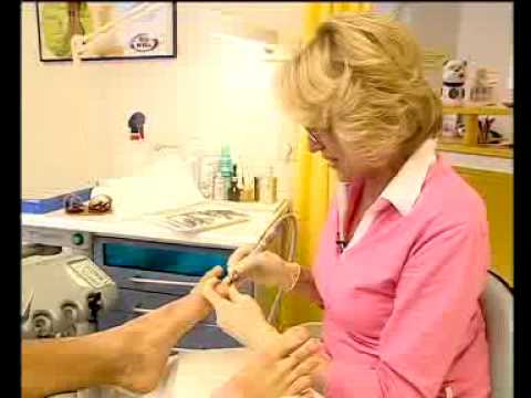 Obst zur Stärkung der Gelenke Radial Anatomie der Knochen und Gelenke