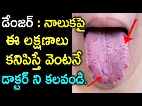 download lagu mp3 mp4 Naluka In Telugu, download lagu Naluka In Telugu gratis, unduh video klip Naluka In Telugu