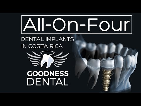 All on 4 Dental Implants in Costa Rica