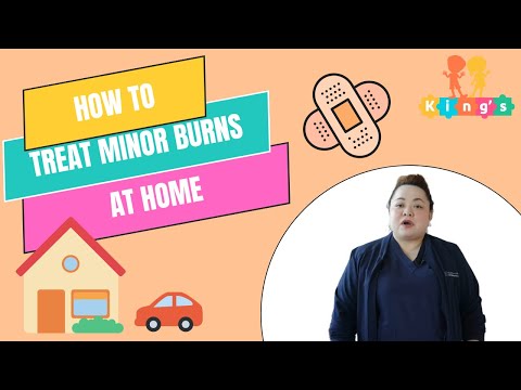 How to Treat Minor Burns at Home | King's College Hospital Dubai - Pediatric Clinic