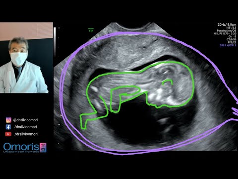 Gravidez de 12 semanas!