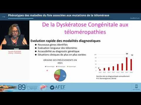 Phénotypes des maladies du foie associées aux mutations de la télomérase - A. PLESSIER - Conf AFEF