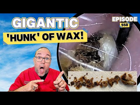 GIGANTIC Hunk of WAX!! Episode 558 (it's an epic!)