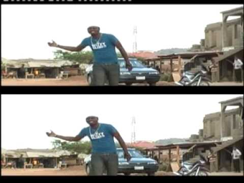 wizblink-i no see my leg