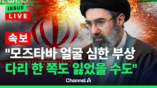 [????이슈를 켜라] [LIVE] 로이터 모즈타바, 얼굴 심한 부상...다리 한 쪽 잃었을 가능성 / 채널A