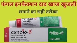 दाद,खाज,खुजली, Fungul Infection की Best दवा | Candid B Cream Uses |