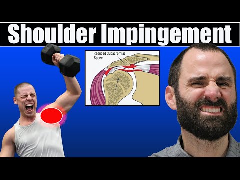 What causes Shoulder Impingement?  Shoulder pain relief Exercises & Stretches