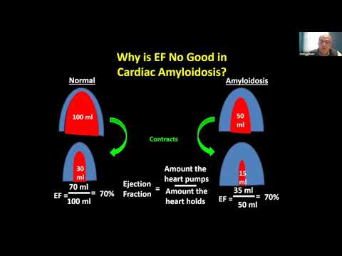 ASG ATTR Webinar, January 21, 2023