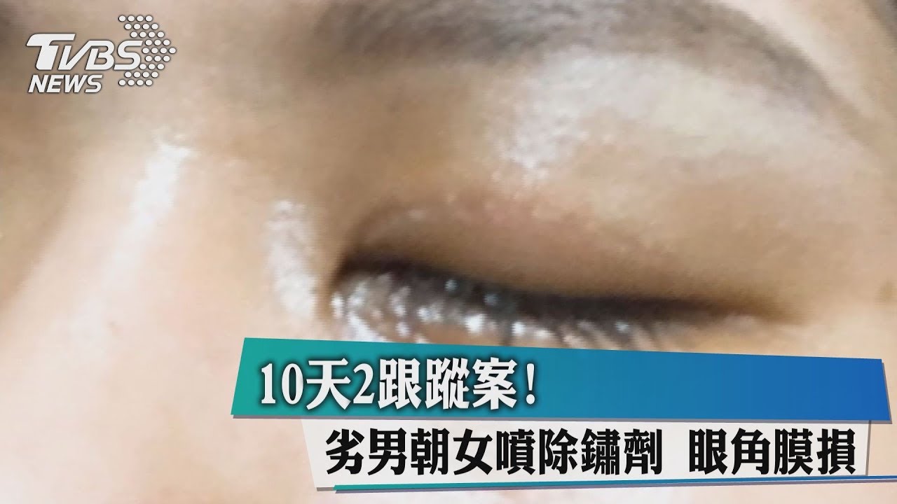 10天2跟蹤案！　劣男朝女噴除鏽劑眼角膜損