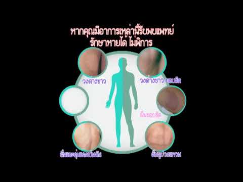 หัวหญ้าเจ้าชู้โรคสะเก็ดเงิน จากการที่ปรากฏโรคสะเก็ดเงินโรค