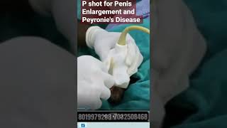 Live P shot for peyronies disease #shorts #reels #penis #health #ed #india #hyderabad #prp