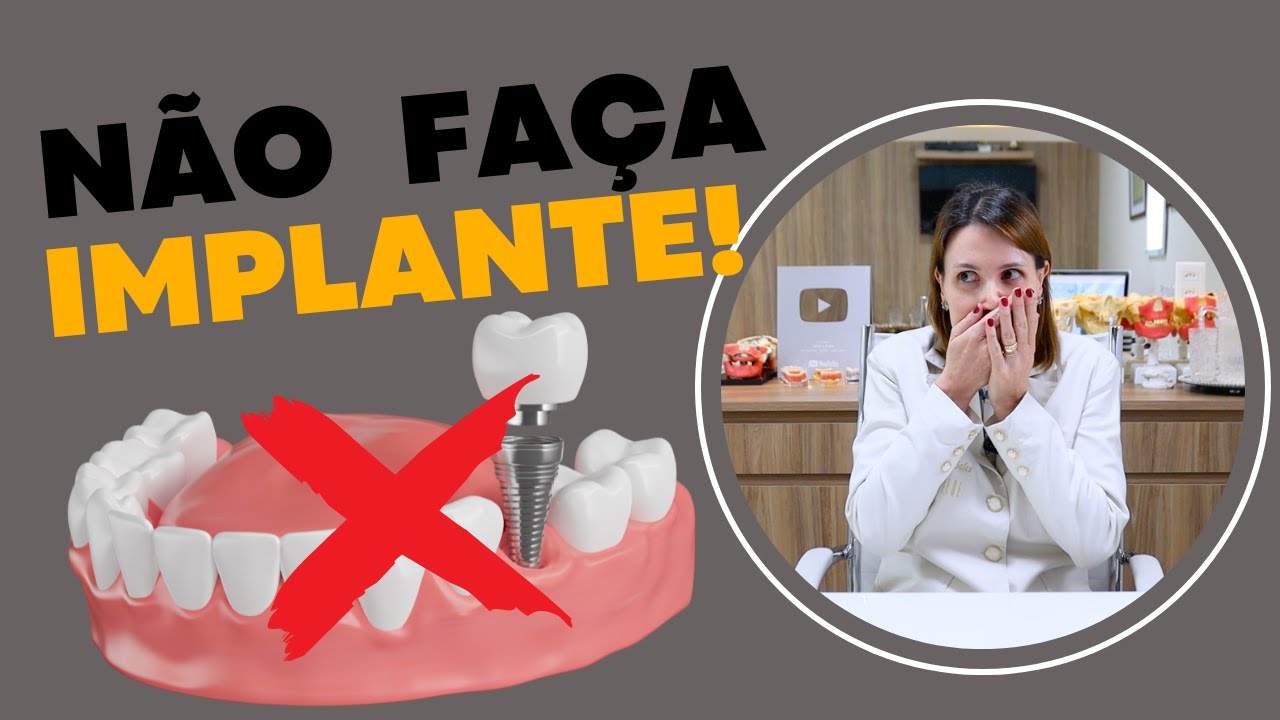 NÃO FAÇA IMPLANTE! Dra. Danielle Sales