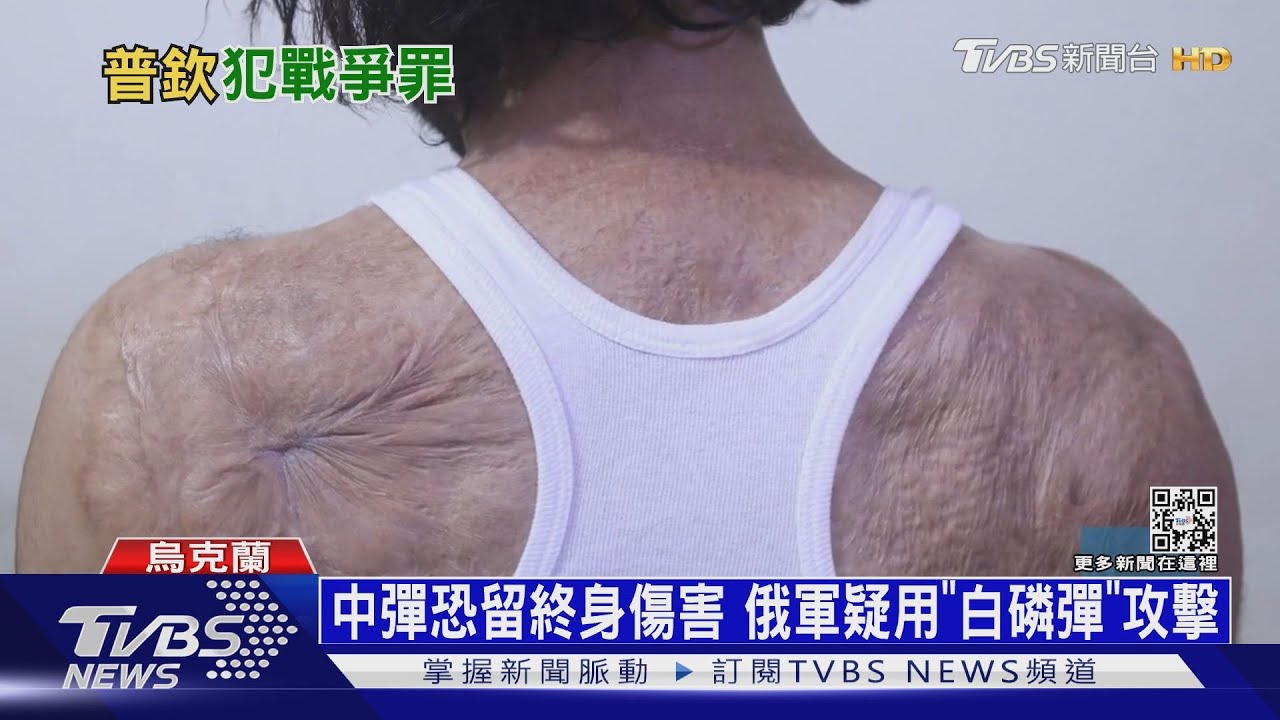 國際法庭入烏克蘭調查 蒐集普欽「戰爭罪」證據