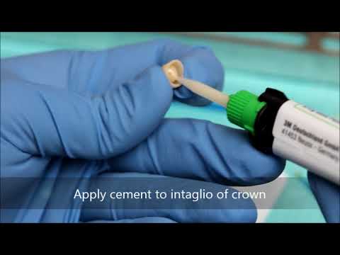 Bonding a zirconia crown