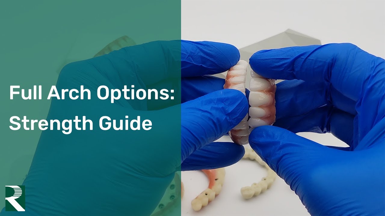 Full Arch Options: Strength Guide