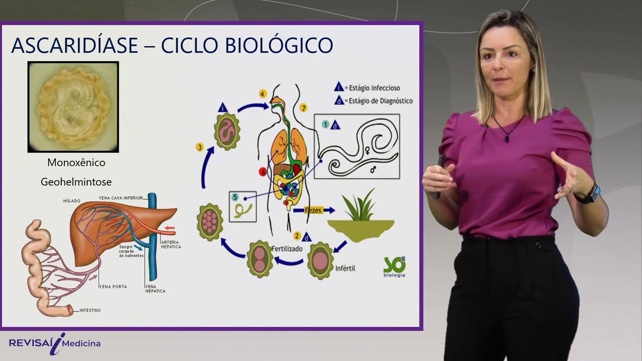 Ascaridíase e Tricuríase - Videoaula | Ciclo Básico de Medicina