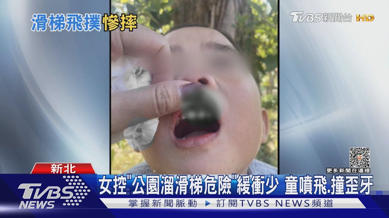 女控「公園溜滑梯危險」緩衝少 童噴飛、撞歪牙