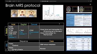 MRI spectroscopy