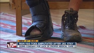Man has toes amputated after jail stay