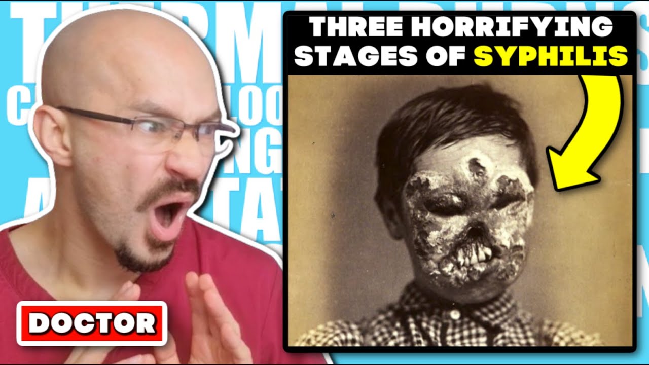 DOCTOR Reacts to The Three Horrifying Stages of Syphilis