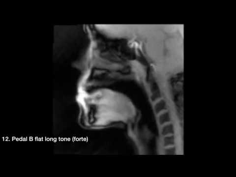 Brass Player MRI
