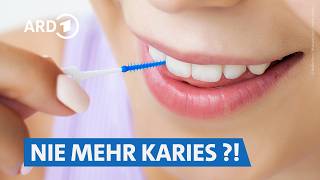 Interdentalbürsten von TePe, Curaprox & Co.: Damit reinigt ihr am besten ✅ | Servicezeit WDR