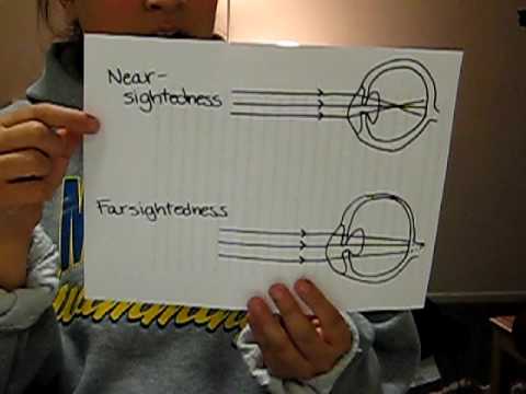 Physics Project on the Eye