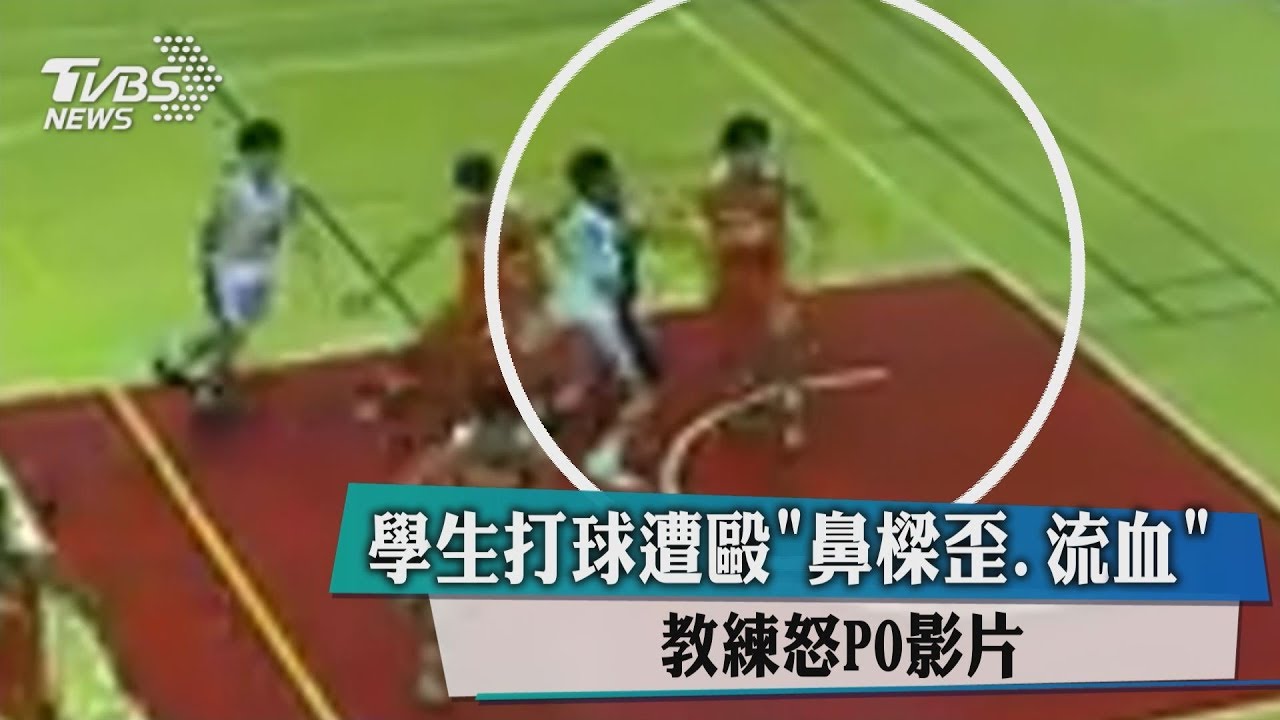 UBA變搏擊？球員鼻樑被毆爆　教練喊：打人就快跑