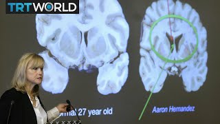 Aaron Hernandez and CTE: Interview with Susan Candiotti