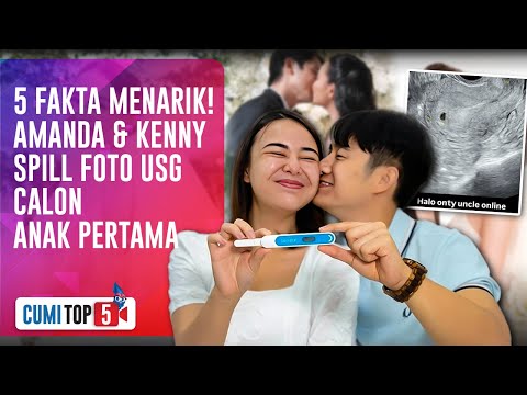 Hamil Anak Pertama! Tangis Amanda Manopo & Kenny Austin Pecah Saat Berbagi Kabar Gembira|CUMI TOP V
