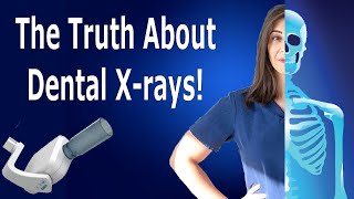 ARE DENTAL X-RAYS DANGEROUS? WHY DENTAL PROFESSIONALS INSIST ON TAKING THEM?
