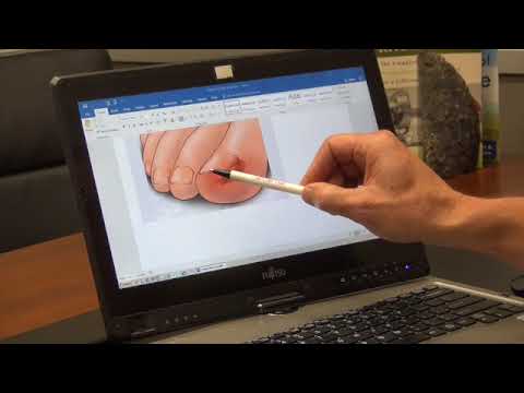 Ask Dr Moore Foot and Ankle FAQ Frequently Asked Questions Video Offering