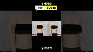 팔뚝 군살 정리 → 매끈한 라인 완성