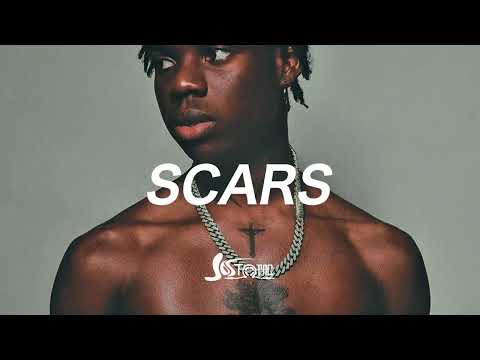 (FREE) Afrobeat Instrumental 2025 | Omah Lay X Rema Type Beat “SCARS” | Emotional Afrobeat Type Beat