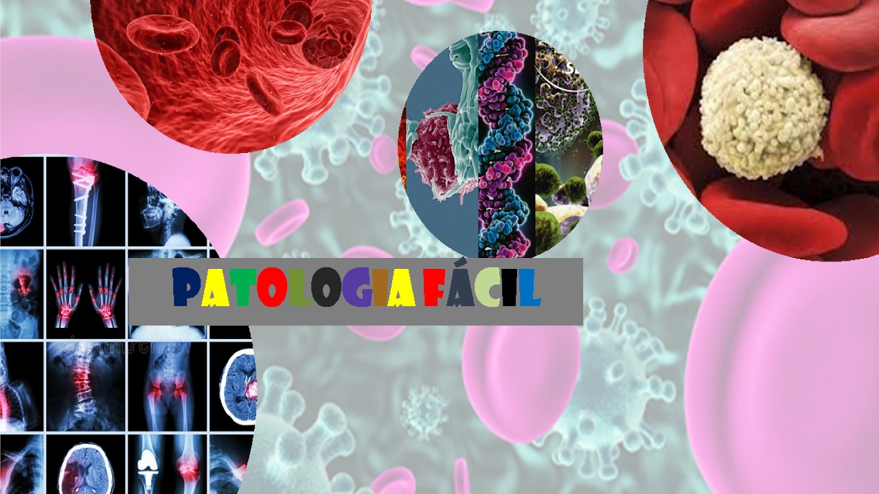 Ossificação endocondral; Ossificação intramembranosa; Reparo de fraturas ósseas