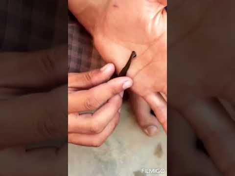 Leeches(Hirudinea), phylum Annelida, #invertebrates #animals