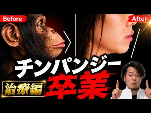 【治療編】チンパンジー卒業