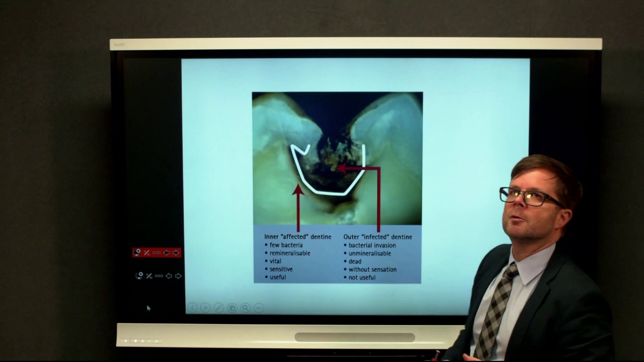 Cavity Design Lecture