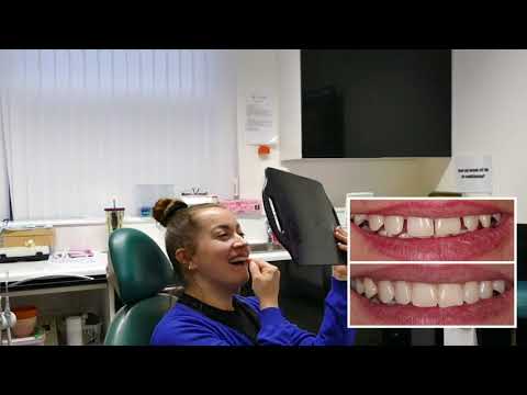 Videos from The Dental Suite - Nottingham